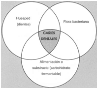 Conociendo la caries dental | Curso Auxiliar Clínica Dental