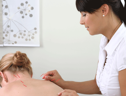 curso de acupuntura