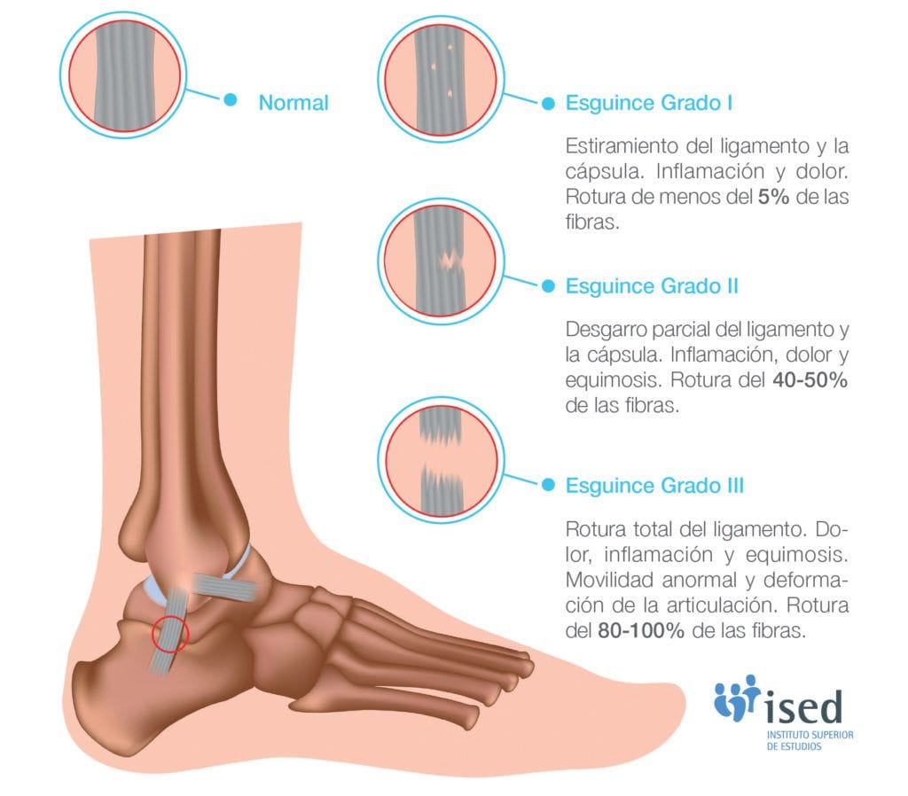 curso de masaje deportivo