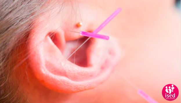 Los-beneficios-de-la-acupuntura-en-la-oreja