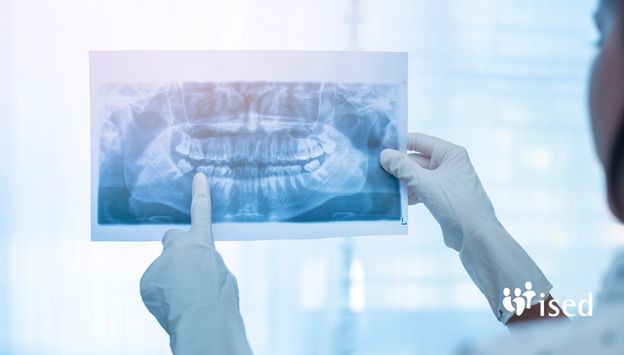 radiologia-dental